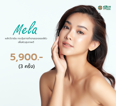 Mela 5 ครั้ง