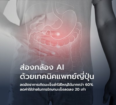โปรแกรมส่องกล้องมะเร็งลำไส้ใหญ่ และกระเพาะอาหาร ด้วยกล้องอัจฉริยะ AI จากญี่ปุ่น