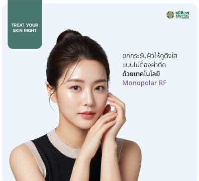 Monopolar RF 600 Shots